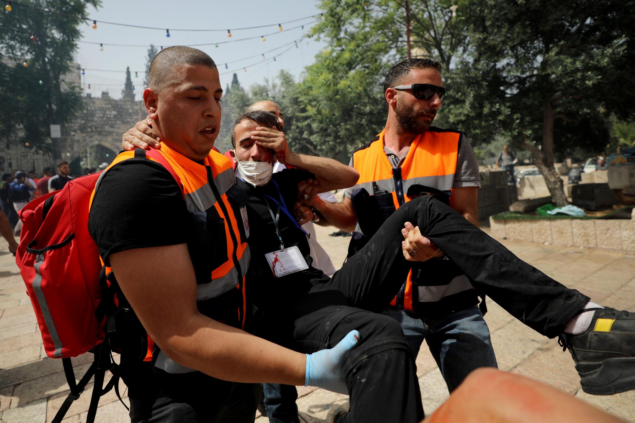 Ισραήλ: Εκατοντάδες τραυματίες στις σφοδρές συγκρούσεις στην Ανατολική Ιερουσαλήμ