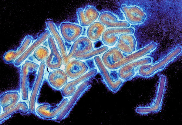 Αιμορραγικός πυρετός Μάρμπουργκ – Τι γνωρίζουμε για τον θανατηφόρο ιό στην Αφρική