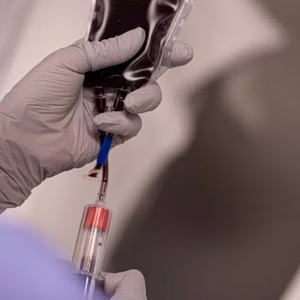 Ομόλογα: Ποια χώρα τα ανταλλάσσει … με αίμα